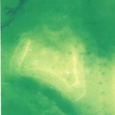 ALC二重染色部位1